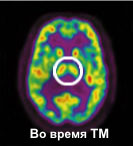 Таламус